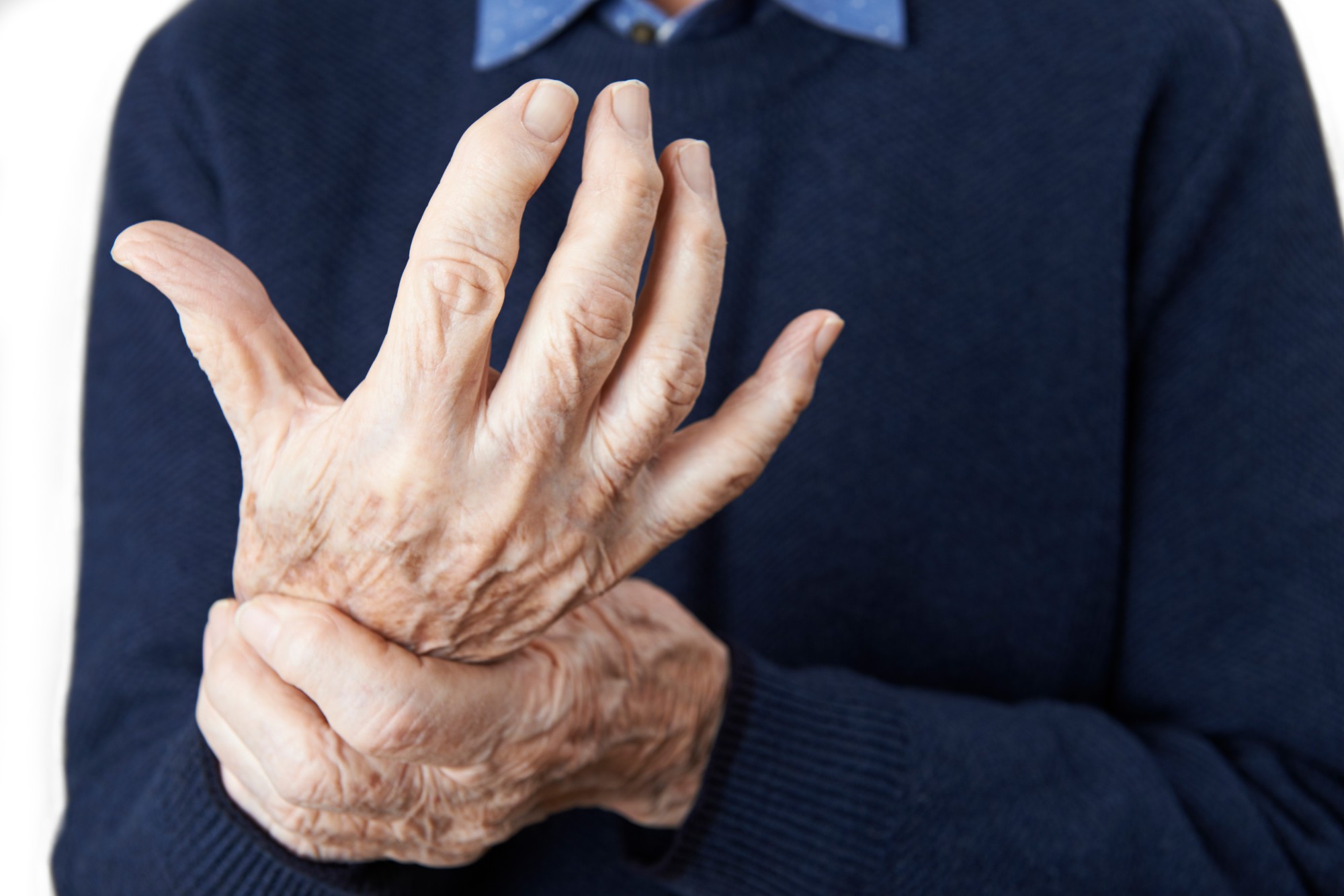 Parkinson’s disease: initial assessment and referral